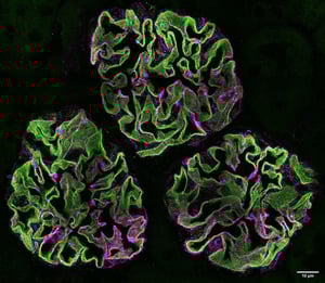 nipoka_3_gloms_sim